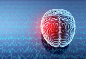 Mri 3D illustration of brain with headache.