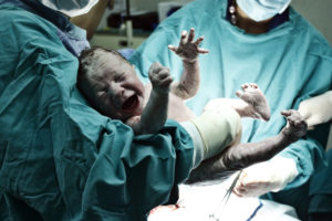 A doctor holding a baby boy minutes after a cesarean birth.