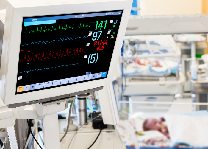 Patients monitor in neonatal ICU