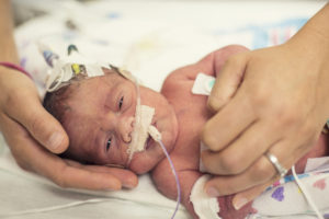 Newborn premature baby in the NICU intensive care