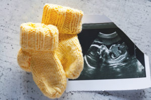Knitted socks for the child, lying on the picture ultrasound. Waiting for the child, ultrasound image.