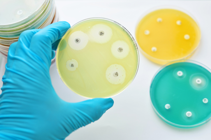 Antimicrobial susceptibility testing in petri dish